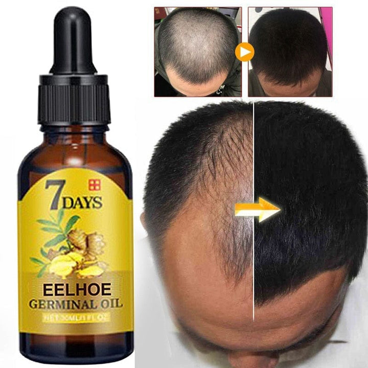 Hair Growth Products Ginger Fast Growing Hair Essential Oil BENNYS