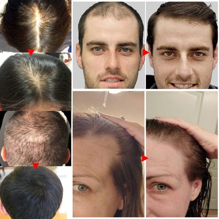 Hair Growth Products Ginger Fast Growing Hair Essential Oil BENNYS