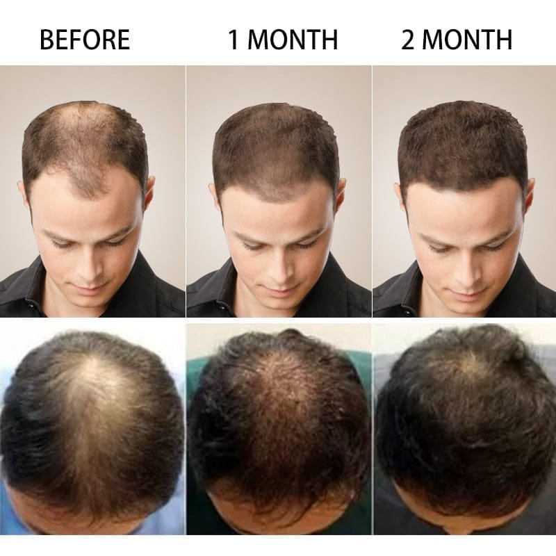 Hair Growth Products Ginger Fast Growing Hair Essential Oil BENNYS