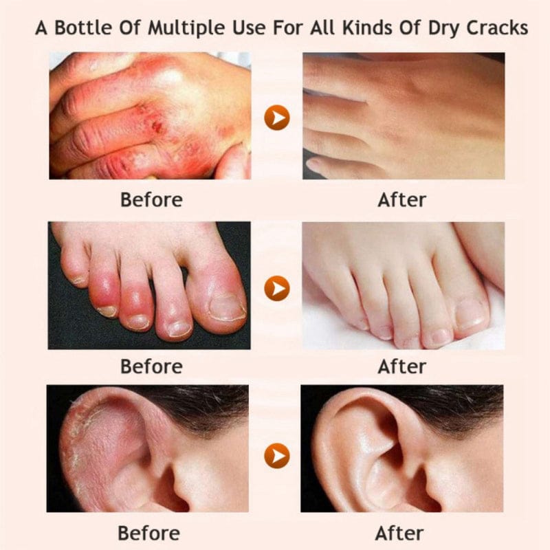 Honey moisturizing cream foot cream leg cream BENNYS