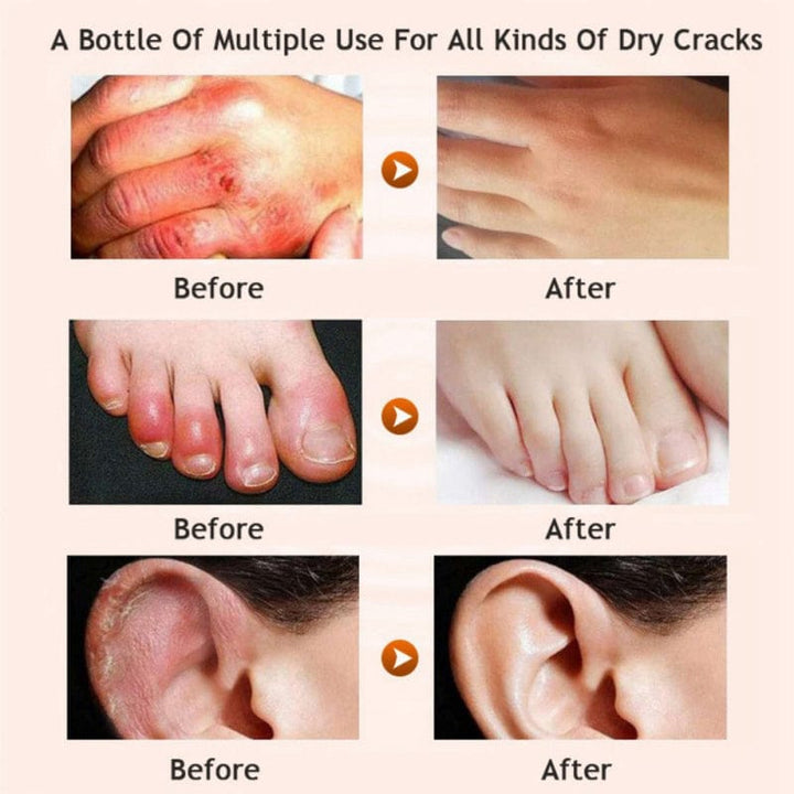Honey moisturizing cream foot cream leg cream BENNYS