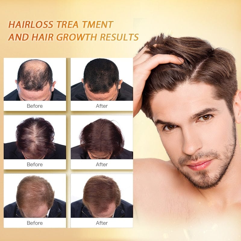 Natural Hair Growth Essence Thickener Regrowth Serum Treatments BENNYS