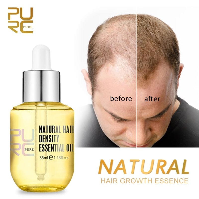 Natural Hair Growth Essence Thickener Regrowth Serum Treatments BENNYS