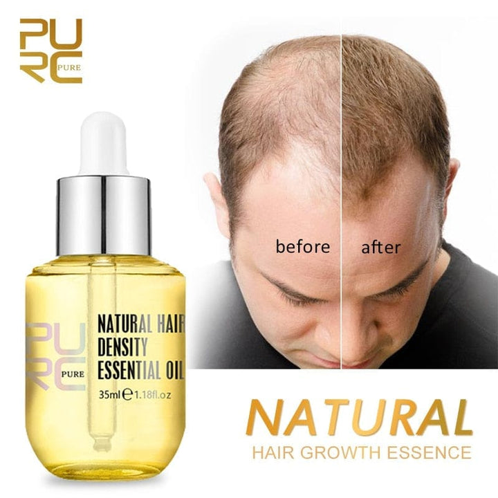 Natural Hair Growth Essence Thickener Regrowth Serum Treatments BENNYS