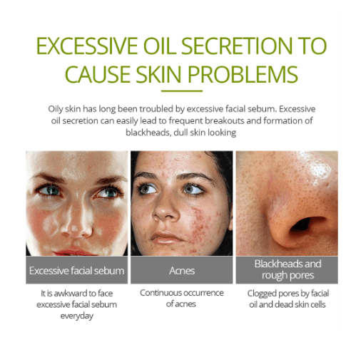 Tea tree acne cream BENNYS