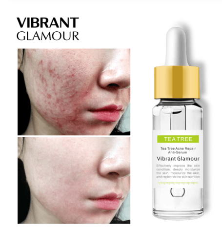 Tea tree acne cream BENNYS