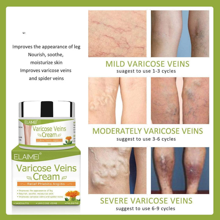 Varicose veins repair cream BENNYS
