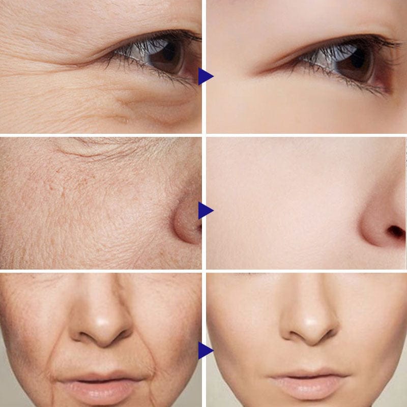 Vitamin C Serum Facial Serum Amazon BENNYS