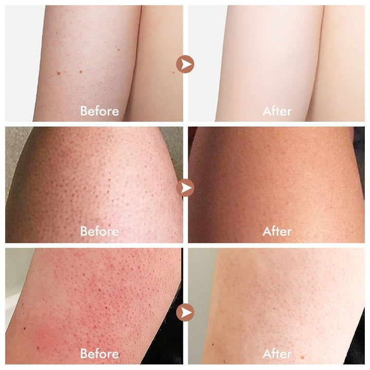 Watermelon Daily Exfoliating Moisturizing Body Scrub BENNYS