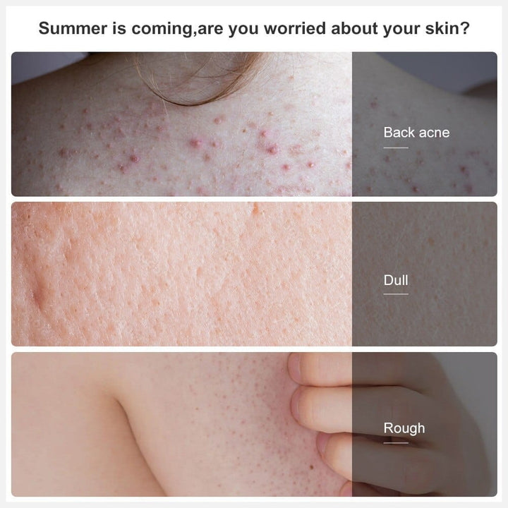 Watermelon Daily Exfoliating Moisturizing Body Scrub BENNYS