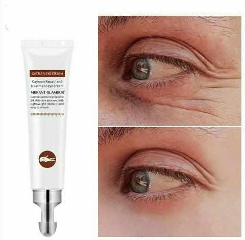 Anti-Aging Wrinkles Eye Cream With Hyaluronic Acid Moisturizing, Dark Circles Puffiness Remover Bennys Beauty World