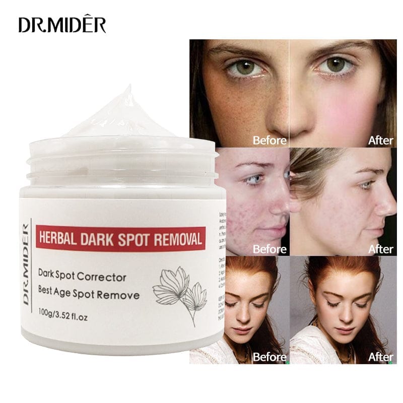 Dark Spot Remover Suitable For Sensitive Skin Bennys Beauty World