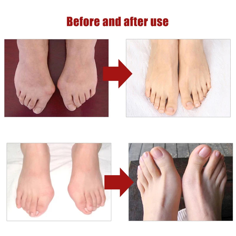 2Pcs=1Pair Silicone Toes Separator