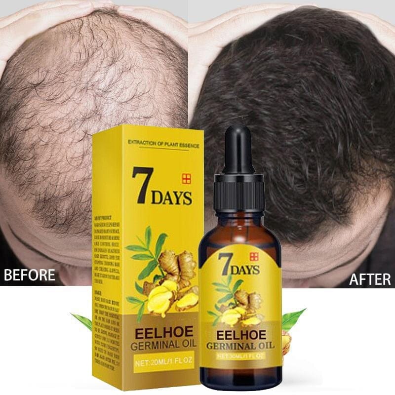 Hair Growth Products Ginger Fast Growing Hair Essential Oil BENNYS 