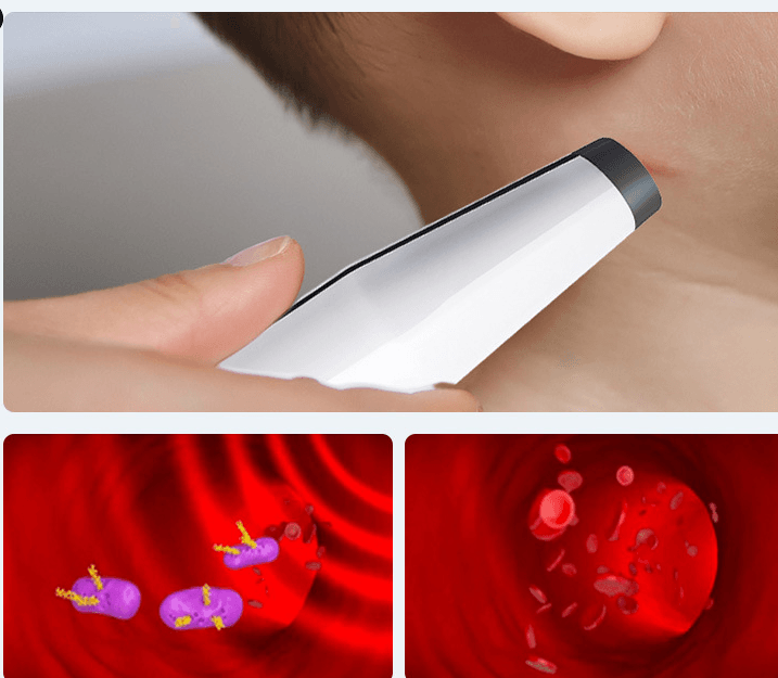Mosquito Antipruritic Device To Eliminate Children's Quick Antipruritic Device Physical Itching Rechargeable Antipruritic Pen BENNYS 