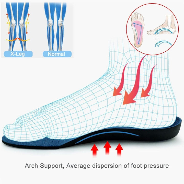 Orthopaedic insoles Arch Support Shoe Inserts BENNYS 