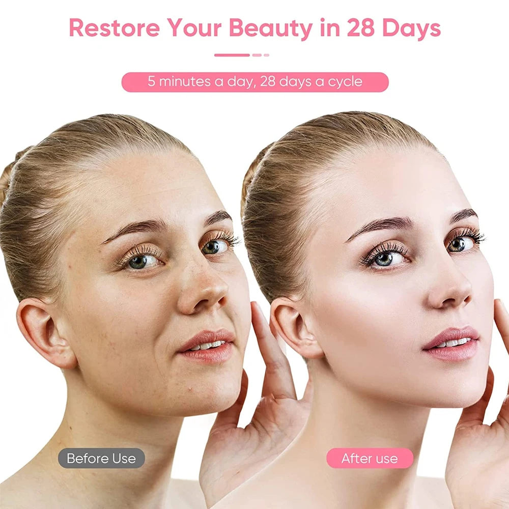 Microcurrent Face Lift Machine Face Roller Massager
