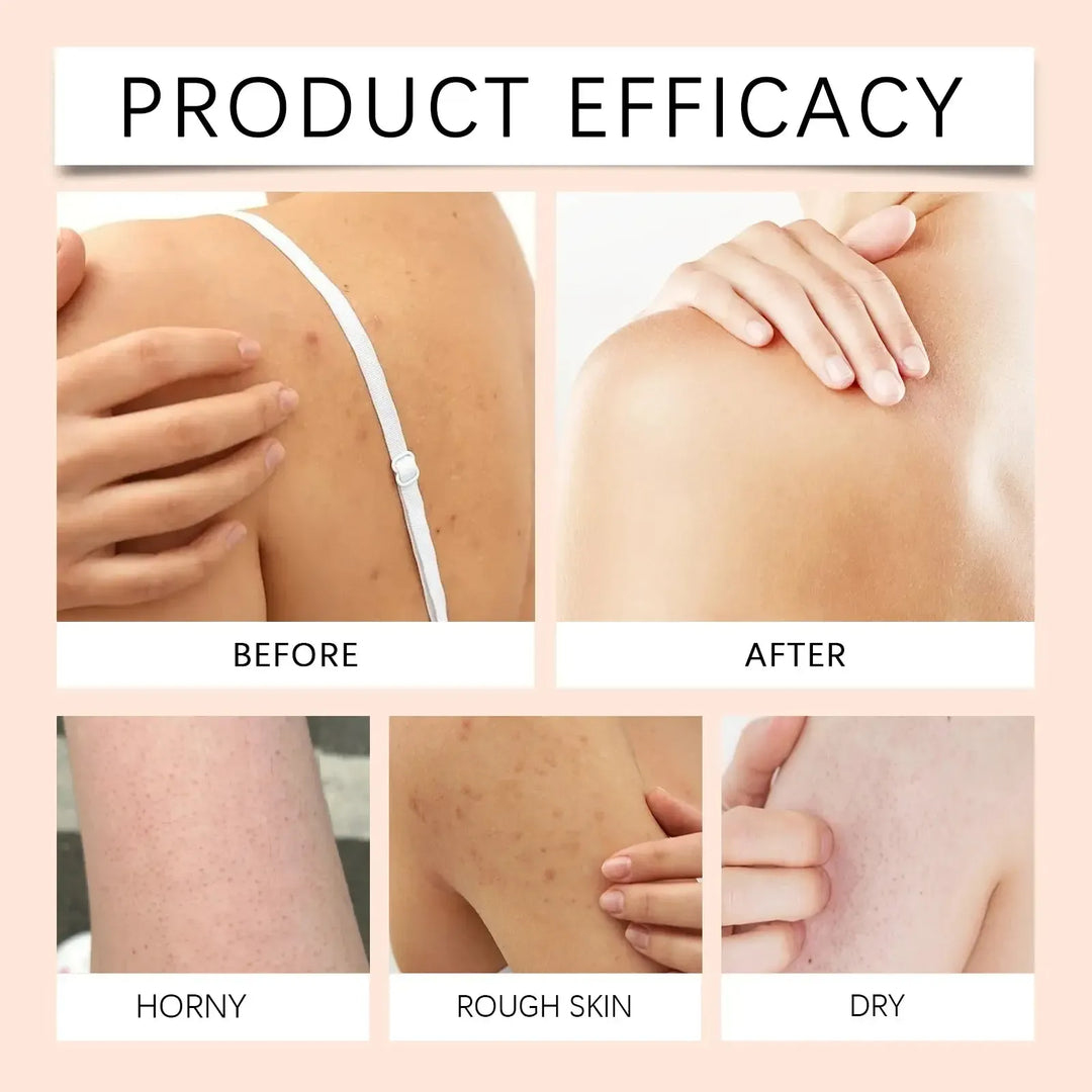 Papaya Whitening Body Wash – Brightening Shower Gel - Bennys Beauty World