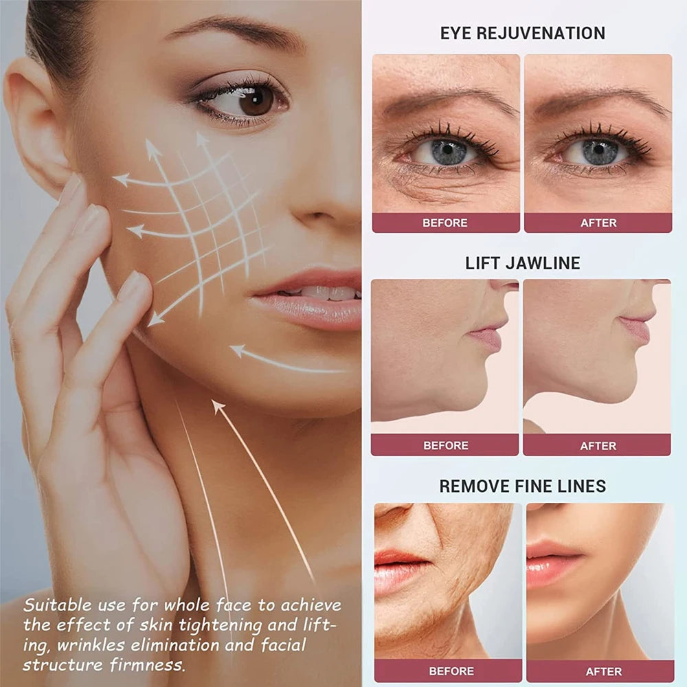 Microcurrent Face Lift Machine Face Roller Massager