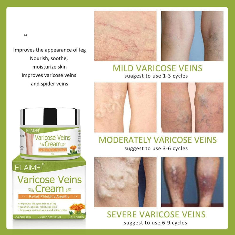 Varicose veins repair cream BENNYS 